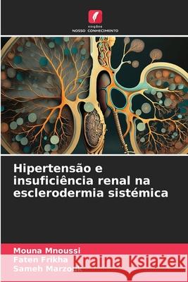 Hipertensão e insuficiência renal na esclerodermia sistémica Mnoussi, Mouna, Frikha, Faten, Marzouk, Sameh 9786208955199 Edições Nosso Conhecimento - książka