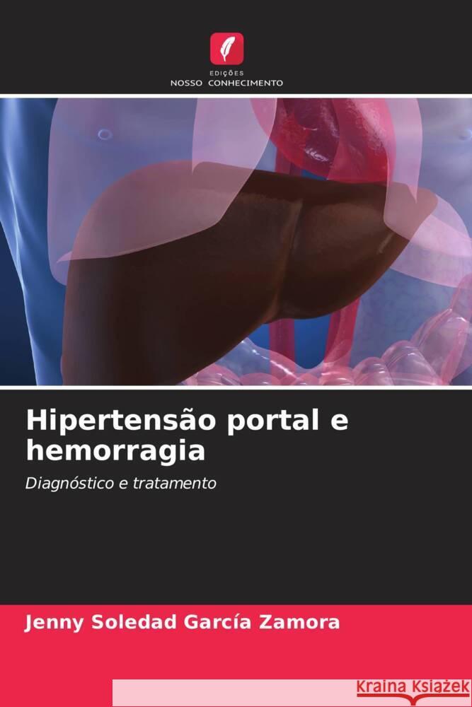 Hipertensão portal e hemorragia García Zamora, Jenny Soledad 9786206946212 Edições Nosso Conhecimento - książka