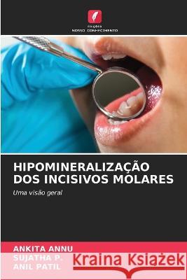 Hipomineralizacao DOS Incisivos Molares Ankita Annu Sujatha P Patil 9786205982419 Edicoes Nosso Conhecimento - książka