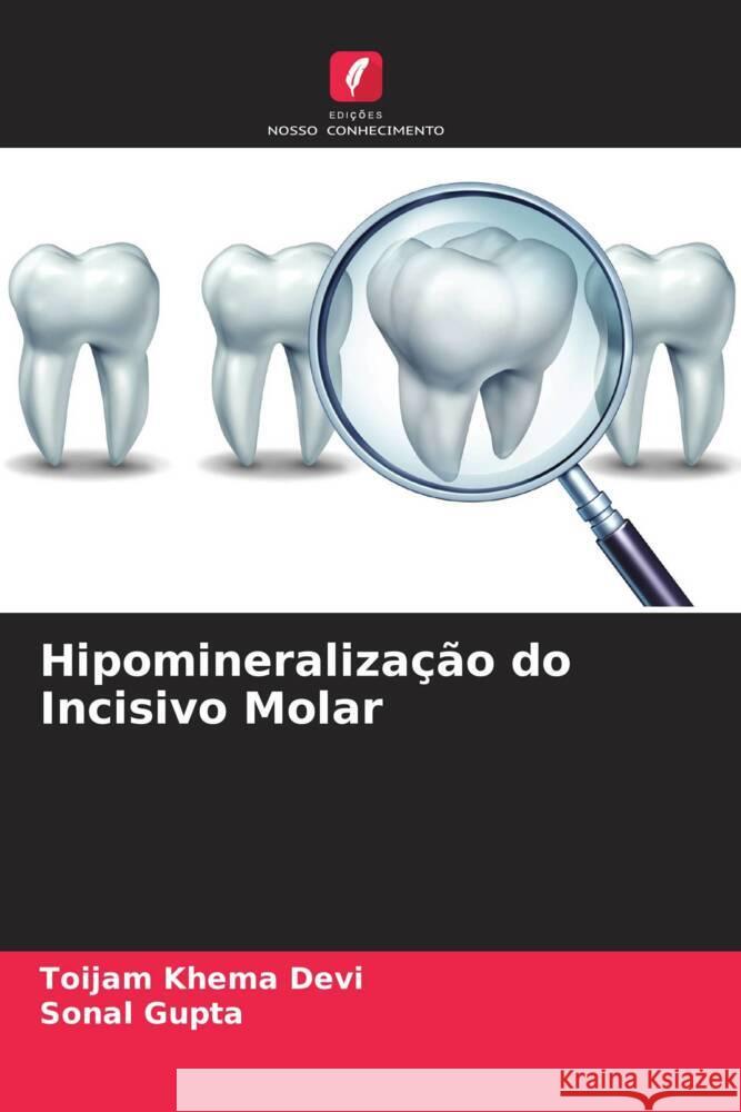 Hipomineralização do Incisivo Molar Devi, Toijam Khema, Gupta, Sonal 9786204714127 Edições Nosso Conhecimento - książka