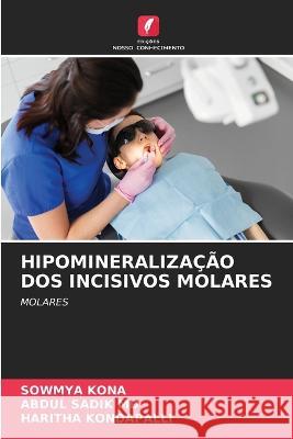 Hipomineraliza??o DOS Incisivos Molares Sowmya Kona Abdul Sadik  Haritha Kondapalli 9786205824306 Edicoes Nosso Conhecimento - książka