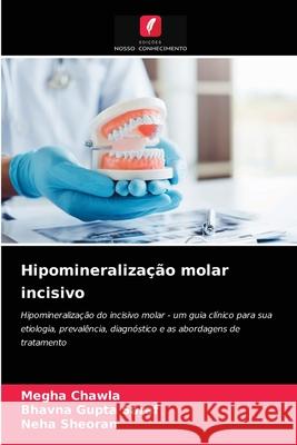 Hipomineralização molar incisivo Megha Chawla, Bhavna Gupta Saraf, Neha Sheoran 9786204060835 Edicoes Nosso Conhecimento - książka