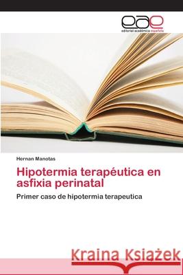 Hipotermia terapéutica en asfixia perinatal Manotas, Hernan 9786202121828 Editorial Académica Española - książka