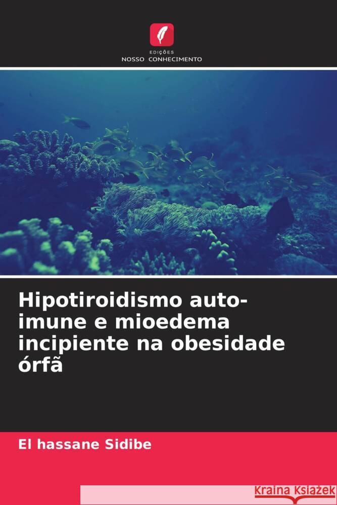 Hipotiroidismo auto-imune e mioedema incipiente na obesidade órfã Sidibé, El Hassane 9786204472782 Edições Nosso Conhecimento - książka