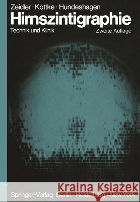 Hirnszintigraphie: Technik Und Klinik Trostdorf, Erich 9783642659928 Springer - książka