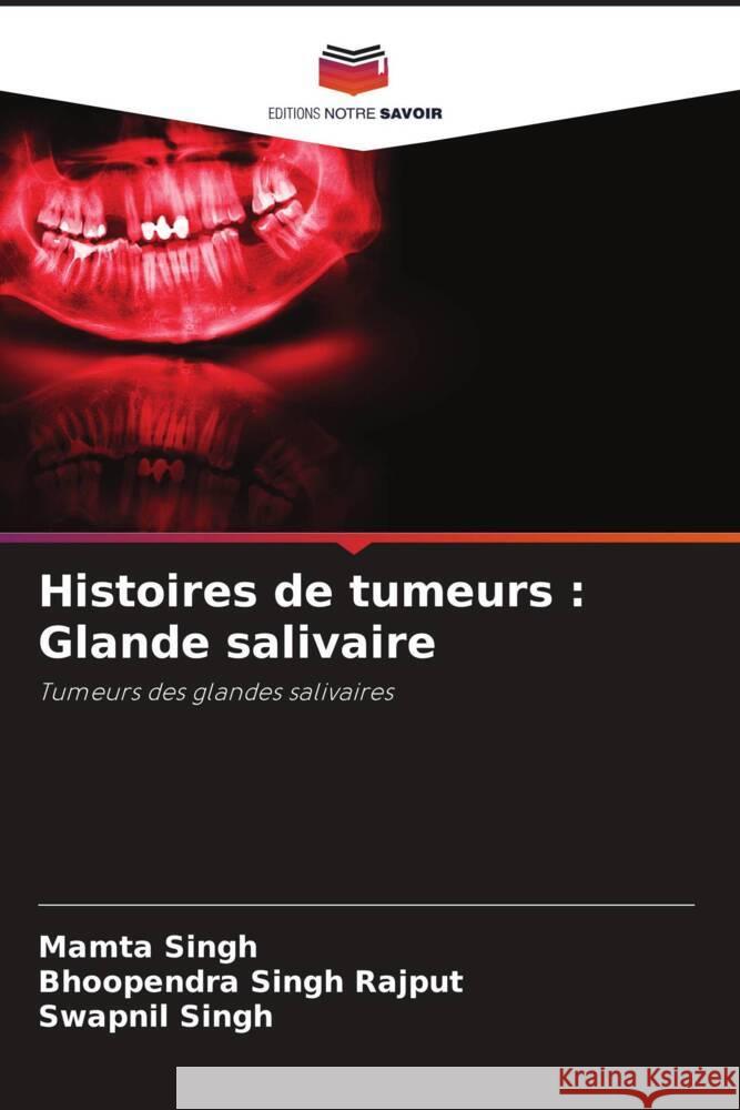 Histoires de tumeurs : Glande salivaire Singh, Mamta, Singh Rajput, Bhoopendra, Singh, Swapnil 9786208626532 Editions Notre Savoir - książka