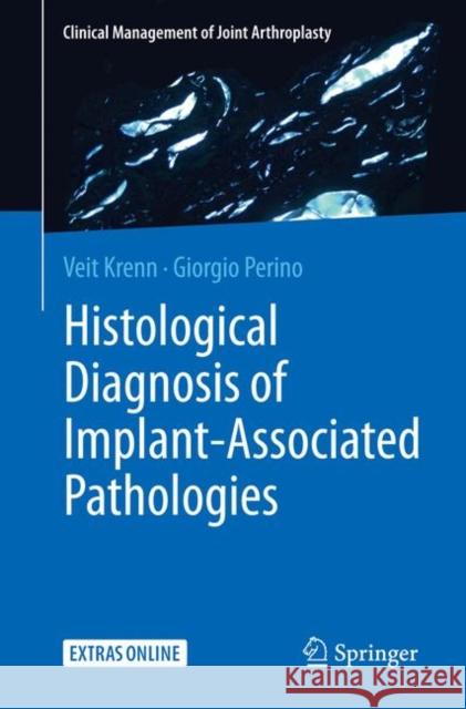 Histological Diagnosis of Implant-Associated Pathologies Krenn, Veit 9783662542033 Springer - książka