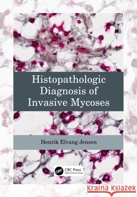 Histopathologic Diagnosis of Invasive Mycoses Henrik Elvang (University of Copenhagen, Denmark) Jensen 9781032306704 Taylor & Francis Ltd - książka