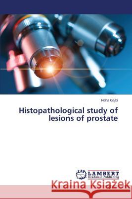 Histopathological Study of Lesions of Prostate Gajbi Neha 9783659515972 LAP Lambert Academic Publishing - książka