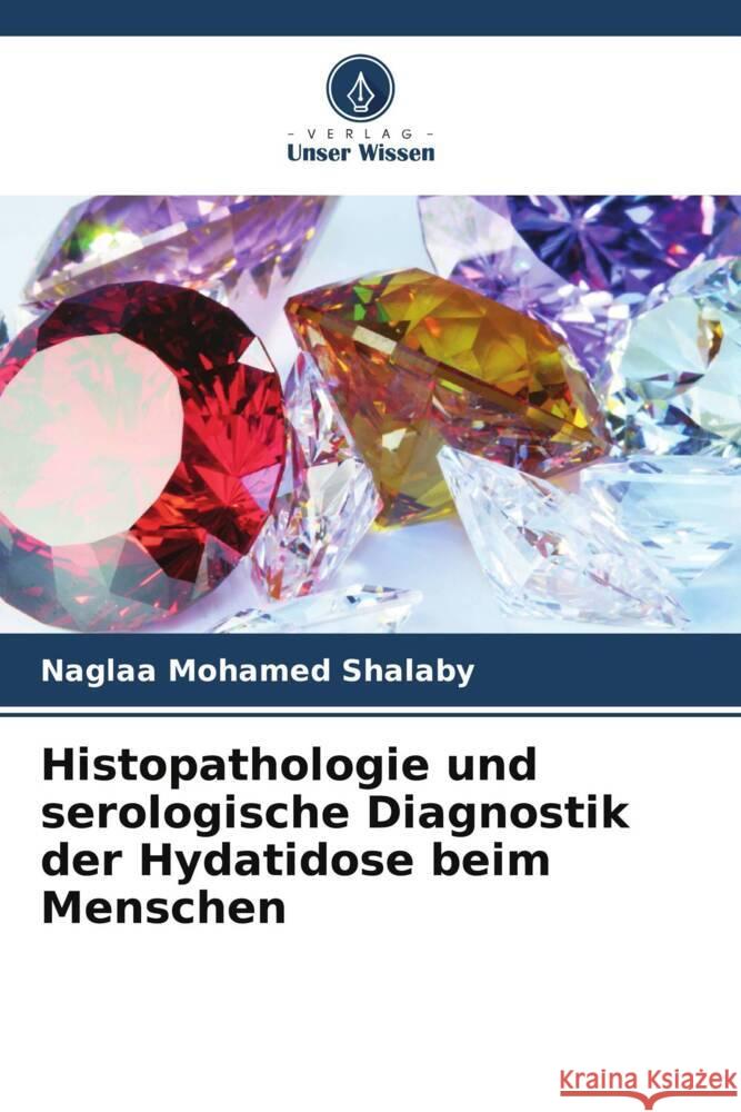 Histopathologie und serologische Diagnostik der Hydatidose beim Menschen Shalaby, Naglaa Mohamed 9786207105267 Verlag Unser Wissen - książka