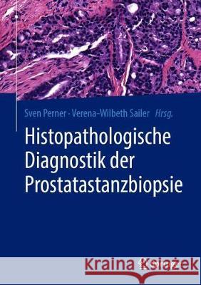 Histopathologische Diagnostik Der Prostatastanzbiopsie Perner, Sven 9783662606421 Springer - książka