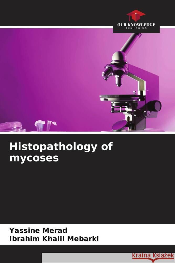 Histopathology of mycoses Merad, Yassine, Mebarki, Ibrahim Khalil 9786205142141 Our Knowledge Publishing - książka