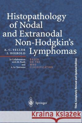 Histopathology of Nodal and Extranodal Non-Hodgkin's Lymphomas Friedrich Schiller Karl Lennert A. C. Feller 9783540638018 Springer - książka