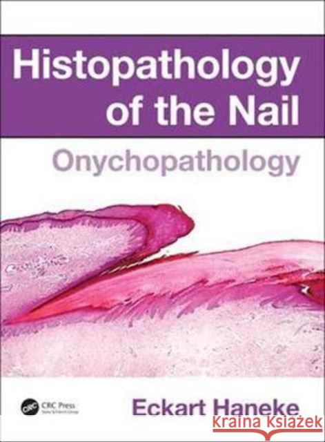 Histopathology of the Nail: Onychopathology Eckart Haneke 9781482212327 CRC Press - książka