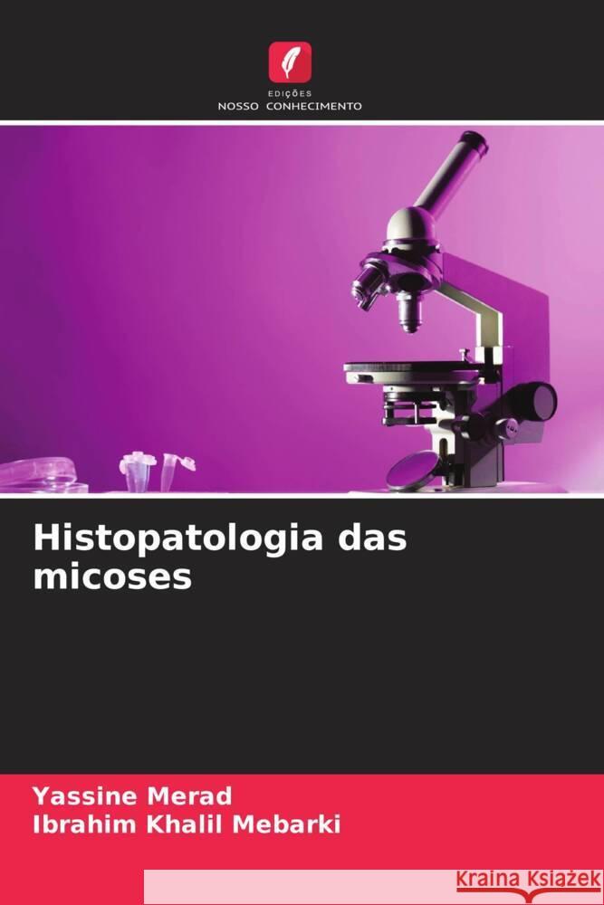 Histopatologia das micoses Merad, Yassine, Mebarki, Ibrahim Khalil 9786205142172 Edições Nosso Conhecimento - książka