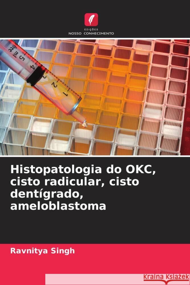 Histopatologia do OKC, cisto radicular, cisto dentígrado, ameloblastoma Singh, Ravnitya 9786204904351 Edições Nosso Conhecimento - książka