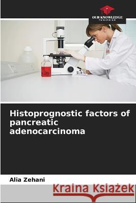 Histoprognostic factors of pancreatic adenocarcinoma Alia Zehani   9786205921159 Our Knowledge Publishing - książka
