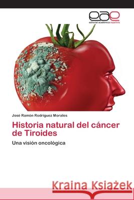 Historia natural del cáncer de Tiroides Rodriguez Morales, José Ramón 9786200430830 Editorial Academica Espanola - książka