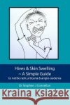 Hives & Skin Swelling A Simple Guide: to nettle rash, urticaria & angio-oedema Connellan, Stephen J. 9781477439340 Createspace