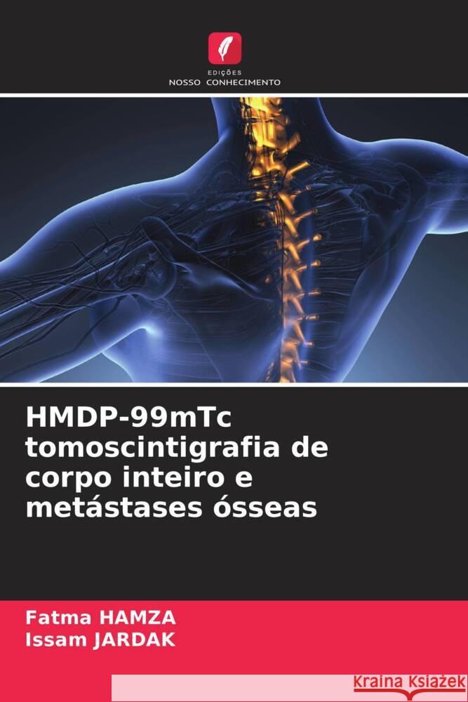 HMDP-99mTc tomoscintigrafia de corpo inteiro e metástases ósseas HAMZA, Fatma, JARDAK, Issam 9786205569382 Edições Nosso Conhecimento - książka