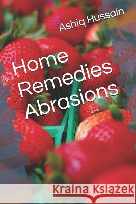 Home Remedies Abrasions Ashiq Hussain 9781095043196 Independently Published - książka