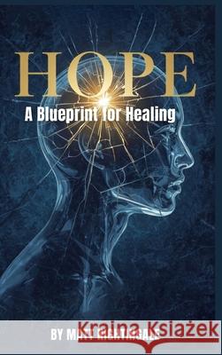 Hope: A Blueprint for Healing Matt Nightingale 9781971232997 Global Publishers - książka