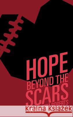Hope Beyond the Scars Kim Roberts 9781629528014 Xulon Press - książka