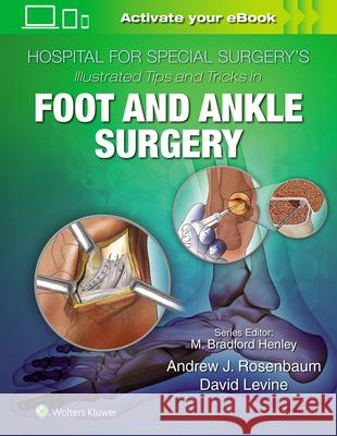 Hospital for Special Surgery's Illustrated Tips and Tricks in Foot and Ankle Surgery David Levine 9781496365101 LWW - książka