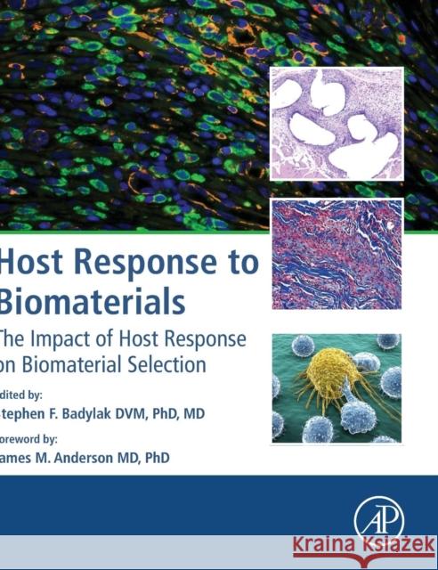 Host Response to Biomaterials: The Impact of Host Response on Biomaterial Selection Stephen F. Badylak 9780128001967 Academic Press - książka