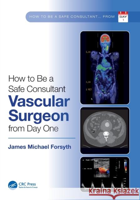 How to be a Safe Consultant Vascular Surgeon from Day One: The Unofficial Guide to Passing the FRCS (VASC) Forsyth, James Michael 9781032285474 Taylor & Francis Ltd - książka