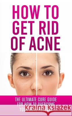 How to Get Rid of Acne: The Ultimate Cure Guide for How to Overcome Your Acne Forever Caesar Lincoln 9781507848715 Createspace - książka