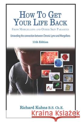 How to Get Your Life Back From Morgellons and Other Skin Parasites Limited Edit Kalmbah, Jonquelyn 9781475010527 Createspace - książka