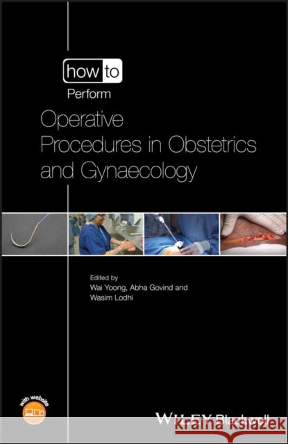 How to Perform Operative Procedures in Obstetrics and Gynaecology Wai Yoong Wasim Lodhi Abha Govind 9781118672884 Wiley-Blackwell - książka