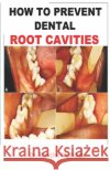 How to Prevent Dental Root Cavities Mahlare, Rantho 9798695406962 Independently Published