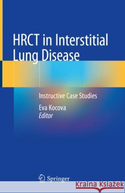 Hrct in Interstitial Lung Disease: Instructive Case Studies Kocova, Eva 9783030163143 Springer - książka