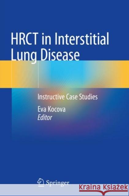 Hrct in Interstitial Lung Disease: Instructive Case Studies Eva Kocova 9783030163174 Springer - książka