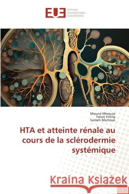 HTA et atteinte rénale au cours de la sclérodermie systémique Mnoussi, Mouna, Frikha, Faten, Marzouk, Sameh 9786208824068 Éditions universitaires européennes - książka