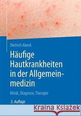 Häufige Hautkrankheiten in Der Allgemeinmedizin: Klinik, Diagnose, Therapie Abeck, Dietrich 9783662574461 Springer - książka