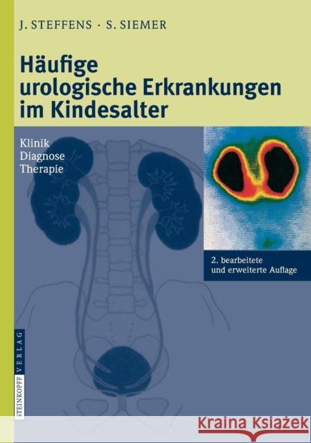 Häufige Urologische Erkrankungen Im Kindesalter: Klinik Diagnose Therapie Steffens, Joachim 9783798517806 Not Avail - książka