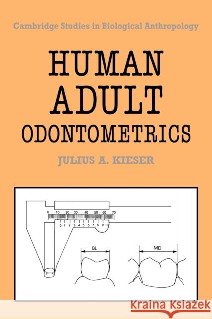 Human Adult Odontometrics: The Study of Variation in Adult Tooth Size Kieser, Julius A. 9780521064590 Cambridge University Press - książka