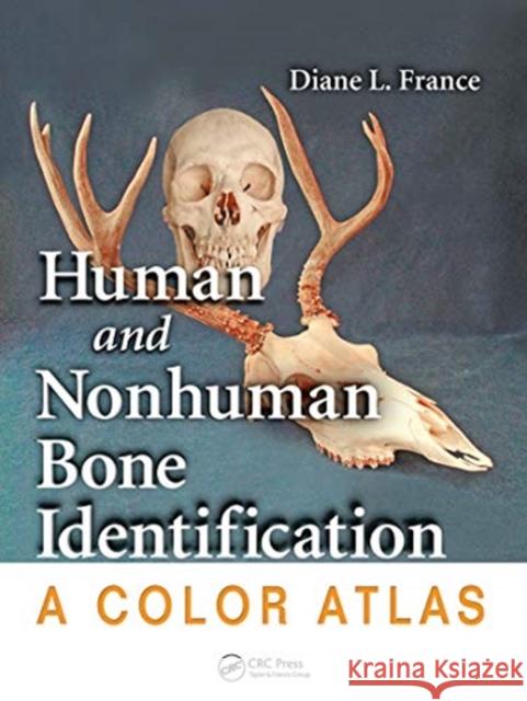 Human and Nonhuman Bone Identification: A Color Atlas France, Diane L. 9780367777913 Taylor and Francis - książka