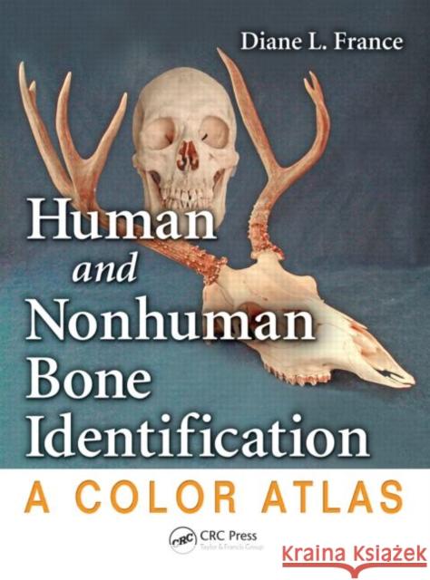 Human and Nonhuman Bone Identification: A Color Atlas France, Diane L. 9781420062861 CRC - książka