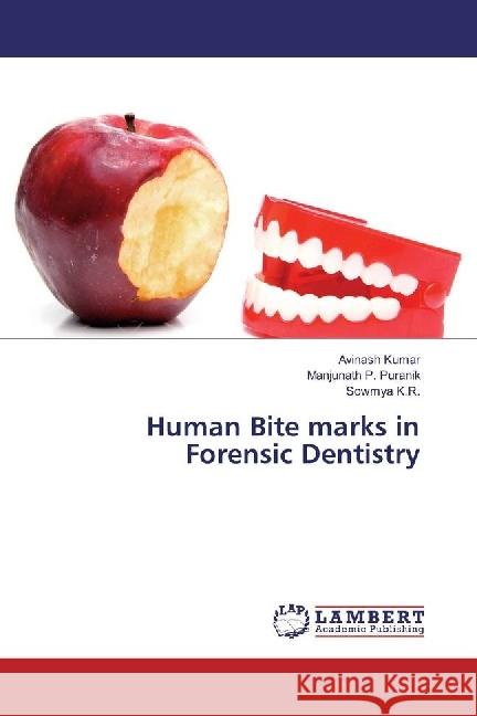 Human Bite marks in Forensic Dentistry Kumar, Avinash; Puranik, Manjunath P.; K.R., Sowmya 9783330330979 LAP Lambert Academic Publishing - książka