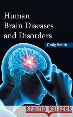 Human Brain Diseases and Disorders Craig Smith 9781632422354 Foster Academics - książka