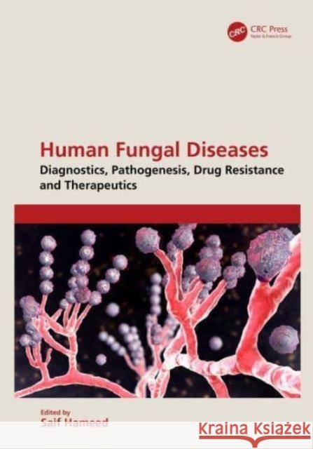 Human Fungal Diseases: Diagnostics, Pathogenesis, Drug Resistance and Therapeutics Saif Hameed 9781032633022 CRC Press - książka