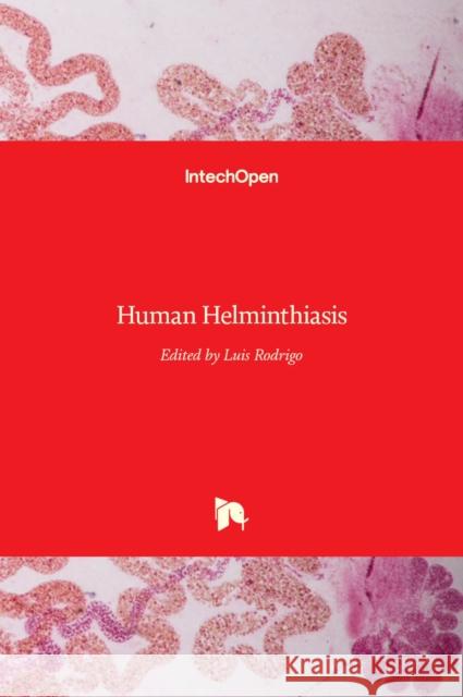 Human Helminthiasis Luis Rodrigo 9789535129530 Intechopen - książka