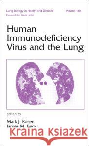 Human Immunodeficiency Virus and the Lung Mark J. Rosen James M. Beck 9780824798833 Marcel Dekker - książka