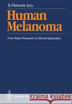 Human Melanoma: From Basic Research to Clinical Application Ferrone, Soldano 9783642744983 Springer - książka