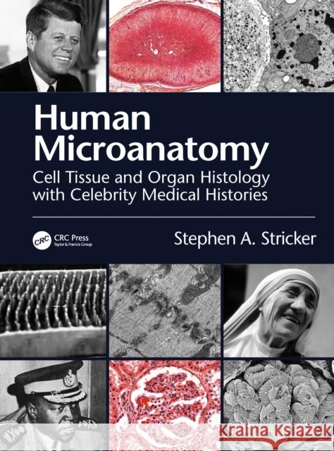 Human Microanatomy: Cell Tissue and Organ Histology with Celebrity Medical Histories Stricker, Stephen A. 9780367364571 CRC Press - książka