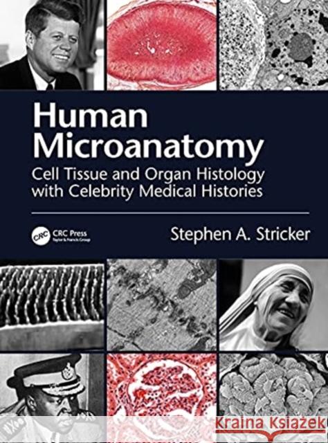 Human Microanatomy: Cell Tissue and Organ Histology with Celebrity Medical Histories Stricker, Stephen A. 9780367771843 CRC Press - książka